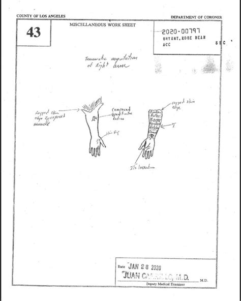 gigi kobe autopsy|Gigi bryant autopsy report